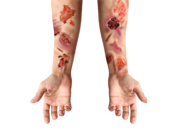 Tatoveringer - Infiserte sår 1 Ark med tatoveringer - 30x13cm 